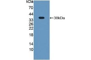 Detection of Recombinant Plg, Rat using Polyclonal Antibody to Plasminogen (Plg) (PLG Antikörper  (AA 191-433))
