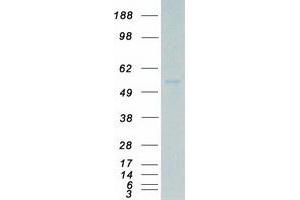 Validation with Western Blot (MATK Protein (Transcript Variant 3) (Myc-DYKDDDDK Tag))