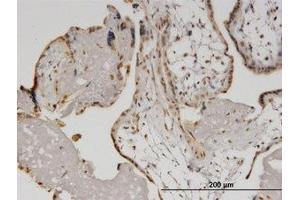 Image no. 4 for anti-Helicase with Zinc Finger (HELZ) (AA 1-101) antibody (ABIN599500) (HELZ Antikörper  (AA 1-101))