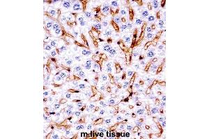 Immunohistochemistry (IHC) image for anti-Mitogen-Activated Protein Kinase 11 (MAPK11) antibody (ABIN2997621) (MAPK11 Antikörper)