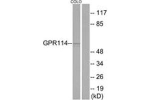 Western blot analysis of extracts from COLO205 cells, using GPR114 Antibody.