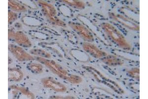 Detection of COX-1 in Human Kidney Tissue using Polyclonal Antibody to Cyclooxygenase 1 (COX-1) (COX-1 Antikörper  (AA 367-599))