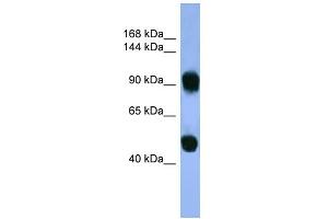 WB Suggested Anti-AP1B1 Antibody Titration: 0.