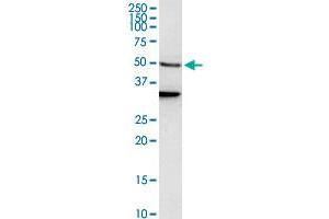 EEF1A1 polyclonal antibody (A01). (eEF1A1 Antikörper  (AA 156-255))