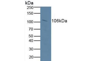 Figure. (Retinoblastoma 1 Antikörper  (AA 639-778))