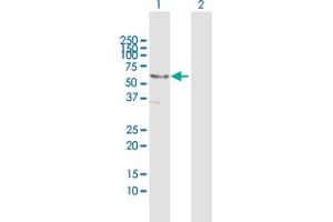 Western Blotting (WB) image for anti-DnaJ (Hsp40) Homolog, Subfamily C, Member 7 (DNAJC7) (AA 1-484) antibody (ABIN950048)