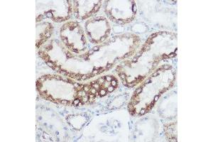 Immunohistochemistry of paraffin-embedded rat kidney using GLUD1 Rabbit pAb (ABIN6127975, ABIN6141157, ABIN6141158 and ABIN6223546) at dilution of 1:100 (40x lens).
