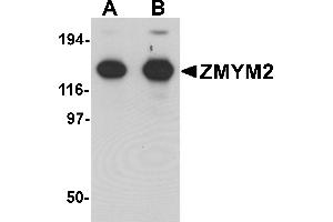 Western blot analysis of ZMYM2 in EL4 cell lysate with ZMYM2 antibody at (A) 0. (ZMYM2 Antikörper  (C-Term))