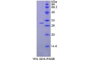SDS-PAGE analysis of Human NAAA Protein. (NAAA Protein)