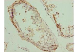 Immunohistochemistry (IHC) image for anti-Pleckstrin Homology Domain Containing, Family J Member 1 (PLEKHJ1) (AA 1-149) antibody (ABIN7163654)