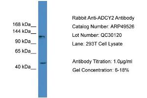 WB Suggested Anti-ADCY2  Antibody Titration: 0. (ADCY2 Antikörper  (Middle Region))