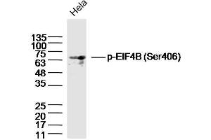 HeLa lysates probed with EIF4B (Ser406) Polyclonal Antibody, Unconjugated  at 1:300 dilution and 4˚C overnight incubation. (EIF4B Antikörper  (pSer406))