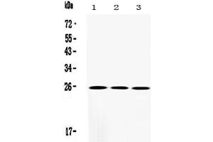 Western blot analysis of SOD2/Mnsod using anti-SOD2/Mnsod antibody . (SOD2 Antikörper  (N-Term))