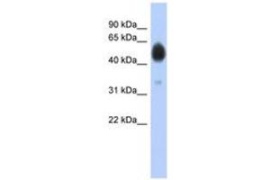 Image no. 1 for anti-Arylsulfatase A (ARSA) (AA 37-86) antibody (ABIN6743778) (Arylsulfatase A Antikörper  (AA 37-86))