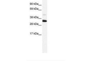 Image no. 2 for anti-Annexin A3 (ANXA3) (N-Term) antibody (ABIN202243) (Annexin A3 Antikörper  (N-Term))