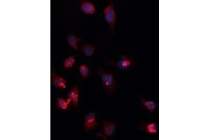 ABIN6266711 staining Daudi cells by IF/ICC.