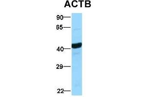 Host:  Rabbit  Target Name:  ACTB  Sample Type:  Hela  Antibody Dilution:  1.