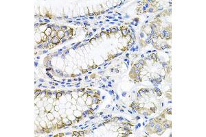 Immunohistochemistry of paraffin-embedded human stomach using ACVR2A antibody (ABIN5971030) at dilution of 1/100 (40x lens). (ACVR2A Antikörper)