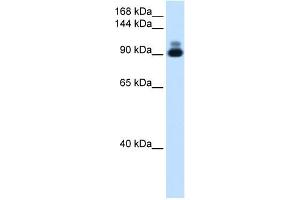 Alpha Actinin 2 antibody used at 1. (ACTN2 Antikörper  (C-Term))