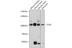 Western blot analysis of extracts of various cell lines, using SV2A antibody (ABIN7270665) at 1:1000 dilution. (SV2A Antikörper  (AA 356-447))