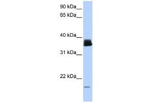 PPIA antibody used at 1 ug/ml to detect target protein. (PPIA Antikörper)