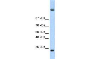 Western Blot analysis of HepG2 cell lysate with DAZ4 polyclonal antibody  at 0.