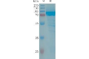 SDS-PAGE (SDS) image for Interleukin 13 Receptor, alpha 2 (IL13RA2) (AA 27-340) protein (Fc Tag) (ABIN7538340)