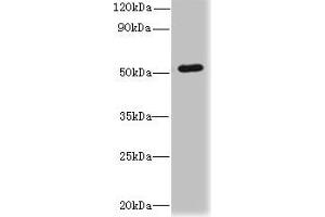 Western blot All lanes: SNX6 antibody at 4 μg/mL + Hela whole cell lysate Secondary Goat polyclonal to rabbit IgG at 1/10000 dilution Predicted band size: 47, 34 kDa Observed band size: 47 kDa (SNX6 Antikörper  (AA 1-290))