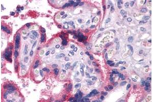 Immunohistochemistry (Formalin-fixed Paraffin-embedded Sections) (IHC (fp)) image for anti-Vitamin K-dependent protein C (PROC) antibody (ABIN574202)