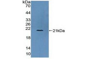 Detection of Recombinant COL6a3, Human using Polyclonal Antibody to Collagen Type VI Alpha 3 (COL6a3) (COL6a3 Antikörper  (AA 463-624))
