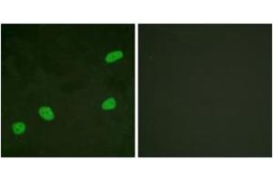 Immunofluorescence analysis of HeLa cells, using ATRIP (Ab-68/72) Antibody.