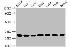 Western Blot Positive WB detected in: Jurkat whole cell lysate, PC3 whole cell lysate, Raji whole cell lysate, K562 whole cell lysate, Hela whole cell lysate, A549 whole cell lysate, HepG2 whole cell lysate All lanes: GSTO1 antibody at 1.