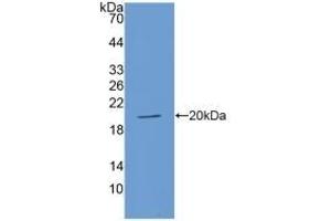 Detection of Recombinant ACE, Human using Polyclonal Antibody to Angiotensin I Converting Enzyme (ACE) (Angiotensin I Converting Enzyme 1 Antikörper  (AA 1160-1306))