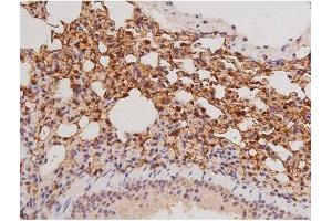 ABIN6269133 at 1/200 staining Mouse lung tissue sections by IHC-P. (KIT Antikörper  (Internal Region))