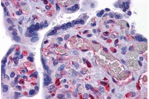 Human Placenta: Formalin-Fixed, Paraffin-Embedded (FFPE) (EFCAB4B Antikörper  (C-Term))