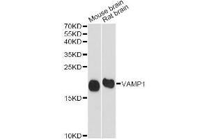 Western blot analysis of extracts of various cell lines, using VAMP1 antibody. (VAMP1 Antikörper  (AA 1-96))