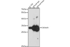 Western blot analysis of extracts of various cell lines, using Calbindin antibody (ABIN6134603, ABIN6137847, ABIN6137848 and ABIN6213988) at 1:1000 dilution. (CALB1 Antikörper  (AA 1-261))