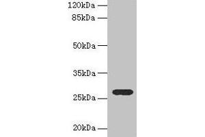 Western blot All lanes: TEX35 antibody at 4 μg/mL + U251 whole cell lysate Secondary Goat polyclonal to rabbit IgG at 1/10000 dilution Predicted band size: 27, 26, 24, 21, 25 kDa Observed band size: 27 kDa (TEX35 Antikörper  (AA 1-215))