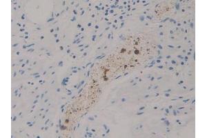 DAB staining on IHC-P; Samples: Human Stomach Tissue (DGKZ Antikörper  (AA 695-932))