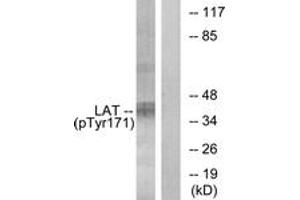 Western blot analysis of extracts from Jurkat cells treated with UV 15', using LAT (Phospho-Tyr171) Antibody. (LAT Antikörper  (pTyr200))