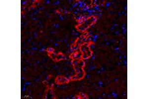 Immunofluorescence of paraffin embedded mouse kidney using CD240d (ABIN7075412) at dilution of 1: 500 (400x lens) (RHD Antikörper)