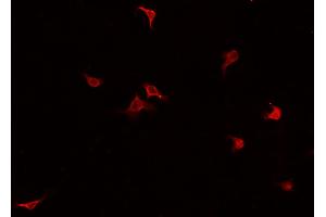 ABIN6269219 staining HUVEC cells by IF/ICC. (Cadherin 5 Antikörper  (C-Term))