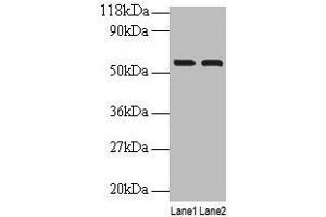 Western blot All lanes: IMPDH2 antibody at 2 μg/mL Lane 1: EC109 whole cell lysate Lane 2: 293T whole cell lysate Secondary Goat polyclonal to rabbit IgG at 1/15000 dilution Predicted band size: 56 kDa Observed band size: 56 kDa (IMPDH2 Antikörper  (AA 5-514))