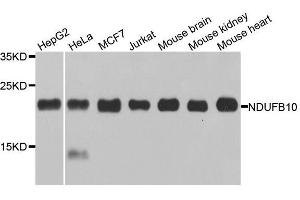 Western blot analysis of extracts of various cell lines, using NDUFB10 antibody.