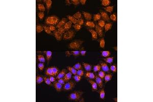 Immunofluorescence analysis of HeLa cells using R Rabbit pAb (ABIN7269787) at dilution of 1:100. (RABL3 Antikörper  (AA 1-236))