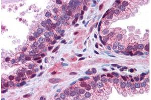 Human Prostate: Formalin-Fixed, Paraffin-Embedded (FFPE) (GID8/C20orf11 Antikörper  (C-Term))