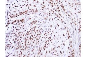 IHC-P Image Immunohistochemical analysis of paraffin-embedded A549 xenograft , using ZNF346, antibody at 1:100 dilution. (ZNF346 Antikörper)