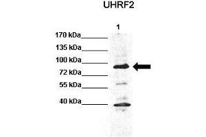 WB Suggested Anti-Uhrf2 Antibody  Positive Control: Lane 1: 60ug HCT116 lysate  Primary Antibody Dilution :  1:1000 Secondary Antibody : Anti rabbit-HRP  Secondry Antibody Dilution :  1:5,000 Submitted by: Chinweike Ukomadu, Brigham and Women's Hospital, Boston