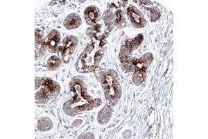 Immunohistochemical staining of human breast with KIAA1586 polyclonal antibody  shows strong cytoplasmic positivity in glandular cells at 1:50-1:200 dilution. (KIAA1586 Antikörper)