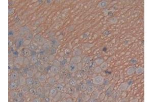 Detection of MAPT in Rat Cerebrum Tissue using Polyclonal Antibody to Tau Protein (MAPT) (tau Antikörper  (AA 34-368))